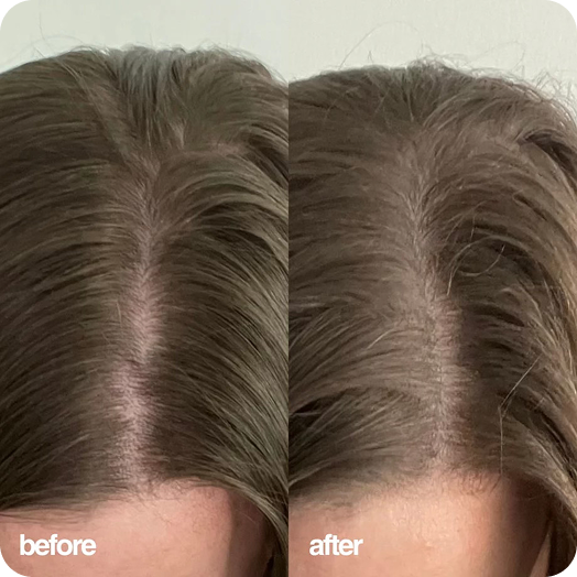 Antoinette before and after